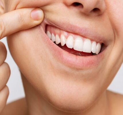 Gum,Health.,Cropped,Shot,Of,A,Young,Woman,Showing,Healthy