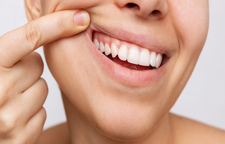 Gum,Health.,Cropped,Shot,Of,A,Young,Woman,Showing,Healthy