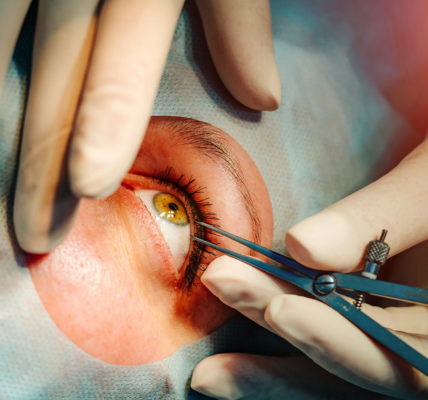 Eye insurance plans
