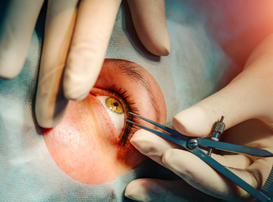 Eye insurance plans