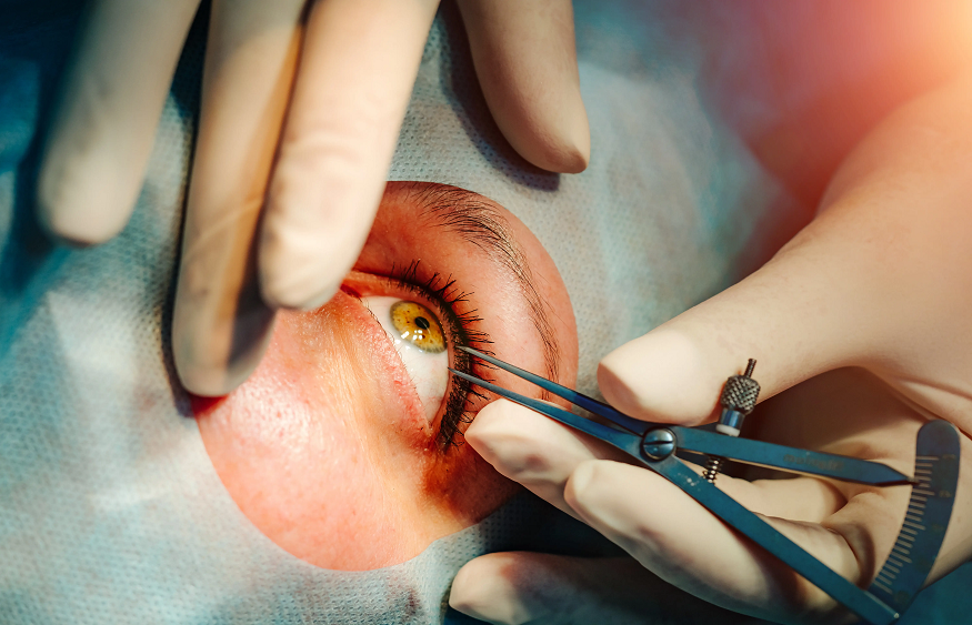 Eye insurance plans